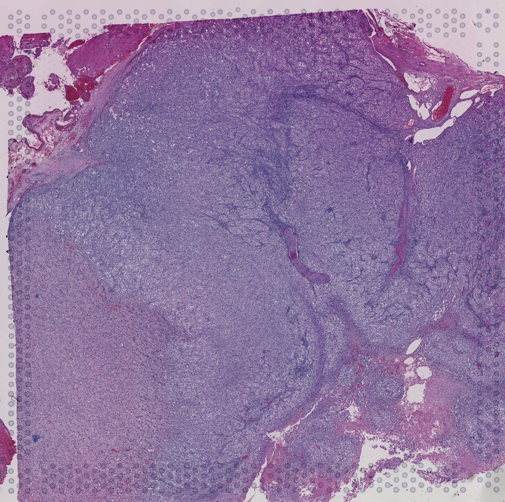 GSM5924036 H&E tissue image with selectable 55 micrometre Visium spots